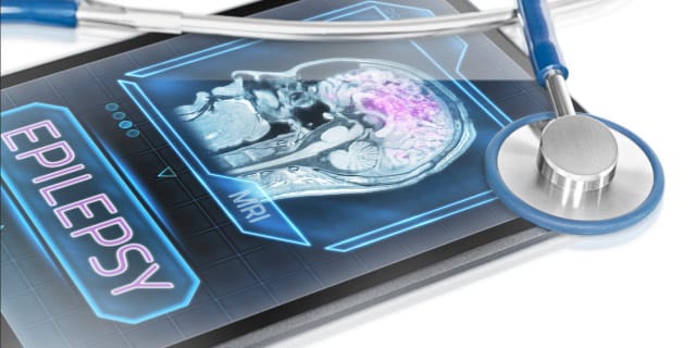 Epilepsy 101 by Alok Pasricha, M.D.